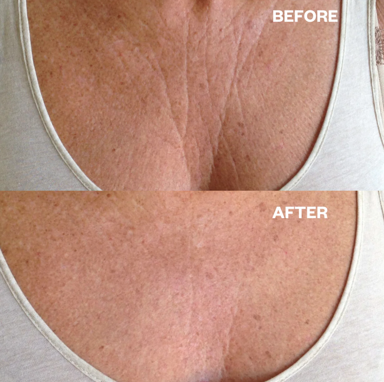 No More Wrinkles Chest Patch